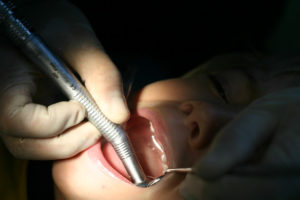 Reclamar indemnización a tu dentista